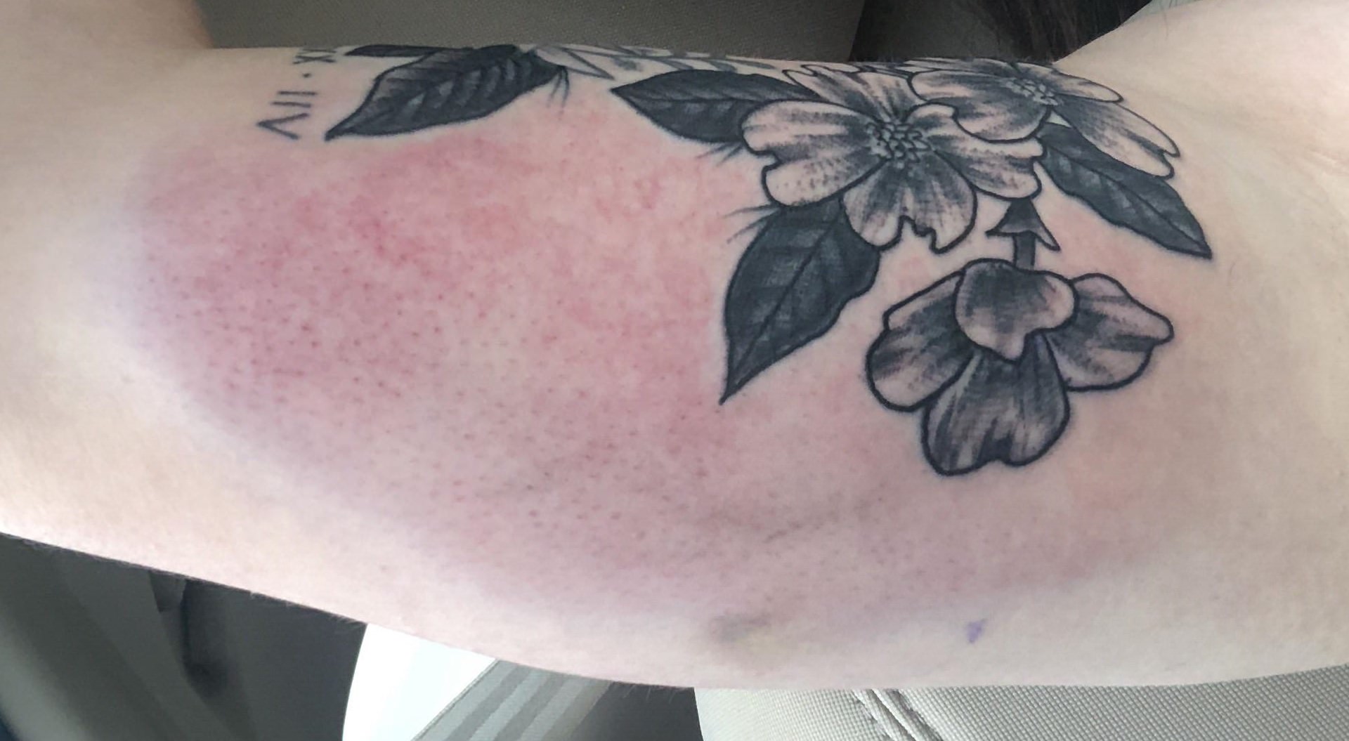 Tattoo blauer Fleck Ursachen & Behandlungstipps! 🤔💉