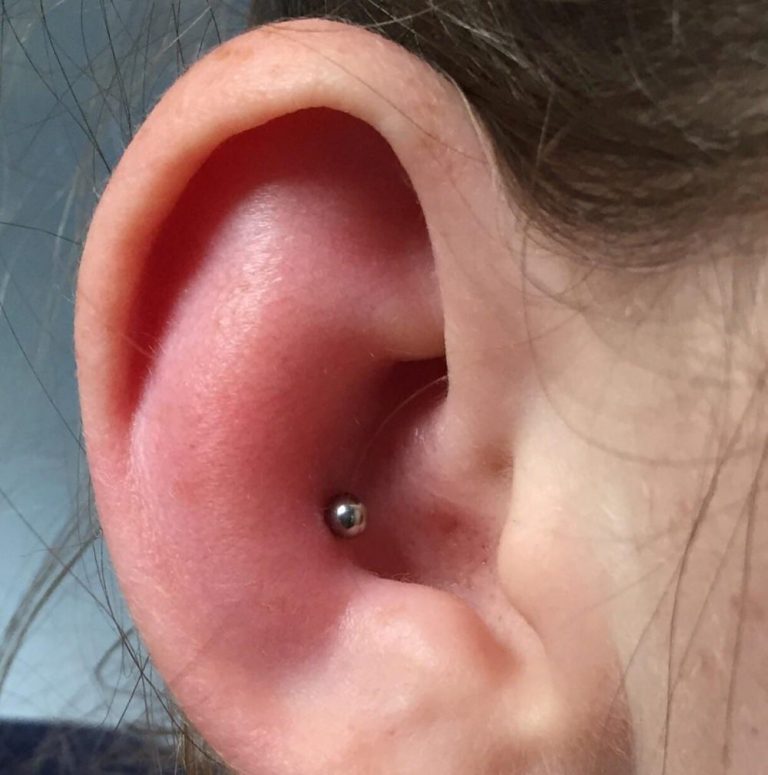 Ear Piercing Swelling Causes and Treatment AuthorityTattoo